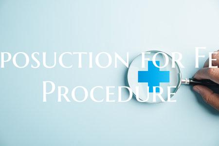 Liposuction for Fess Procedure