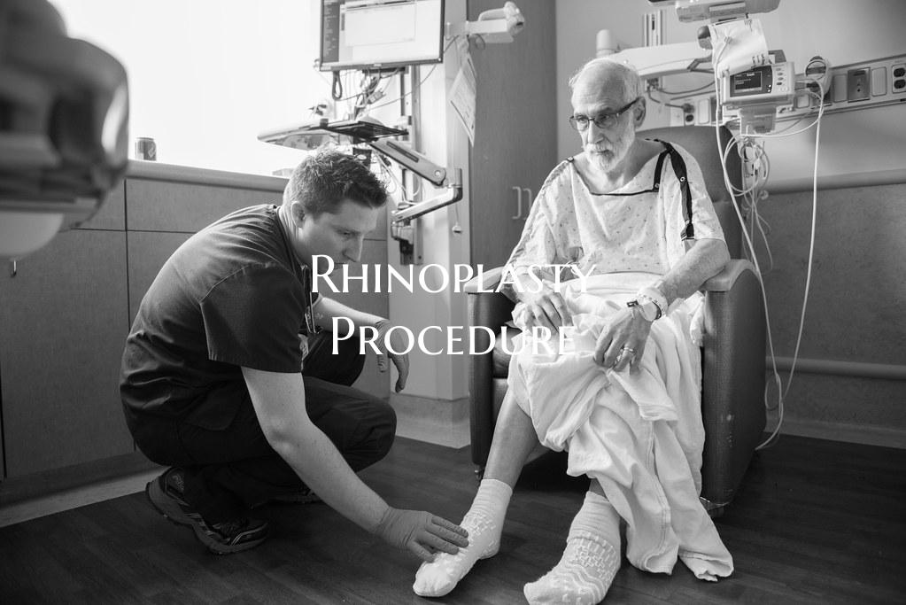 Rhinoplasty Procedure
