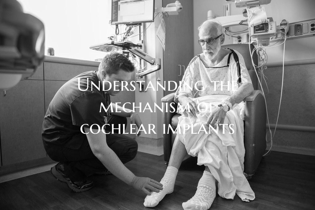 Understanding the mechanism of cochlear implants